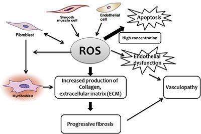 A Potential Link Between Oxidative Stress and <mark class="highlighted">Endothelial-to-Mesenchymal Transition</mark> in Systemic Sclerosis